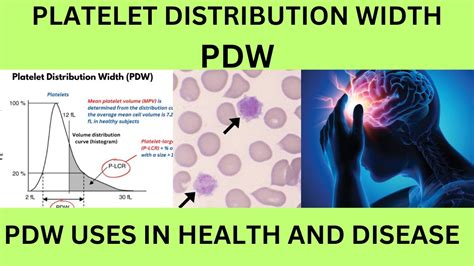 high pdw in blood test|PDW Test (Platelet Distribution Width) .